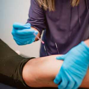Dry Needling Certification — Level 2